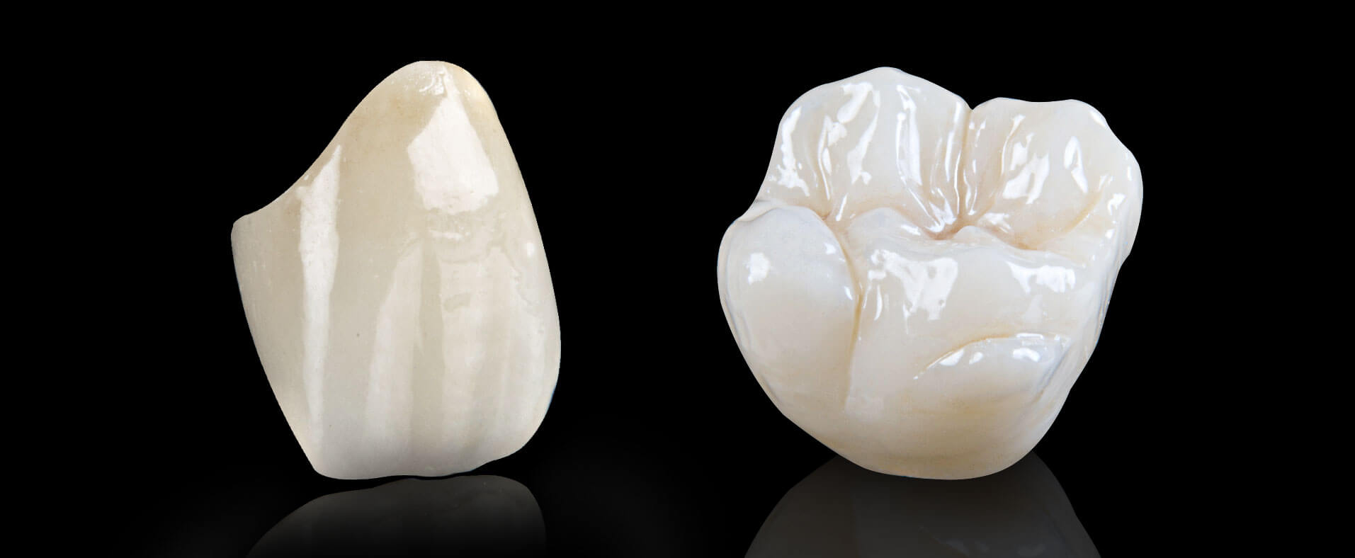 dental-crowns-upper-east-side