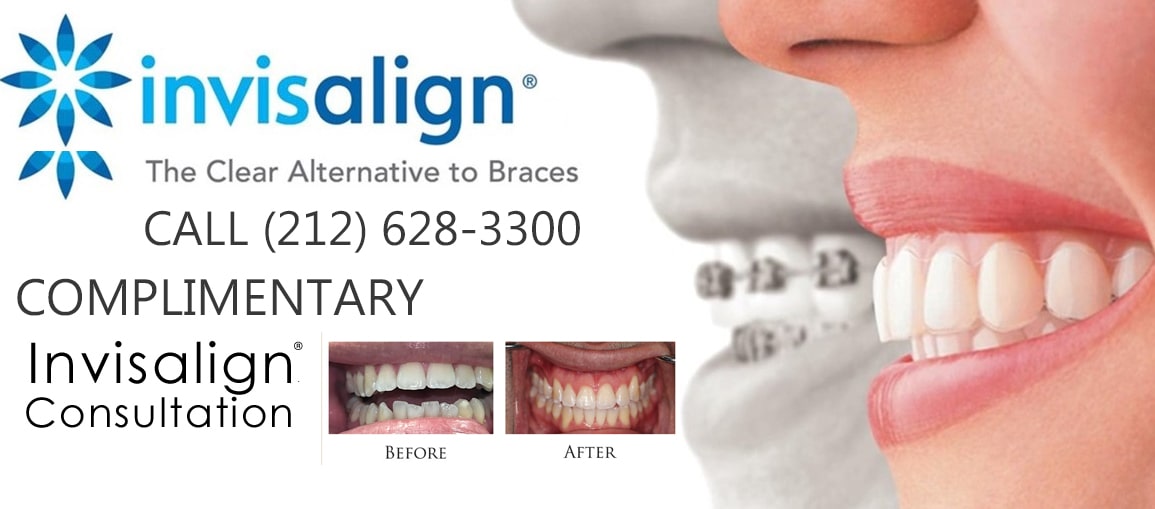 free-invisalign-consultation-nyc