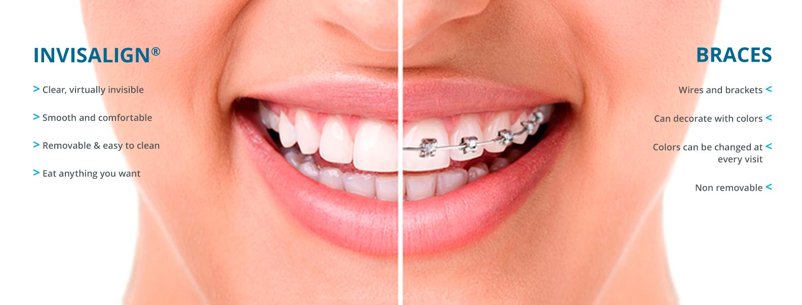 invisalign-dentist-nyc