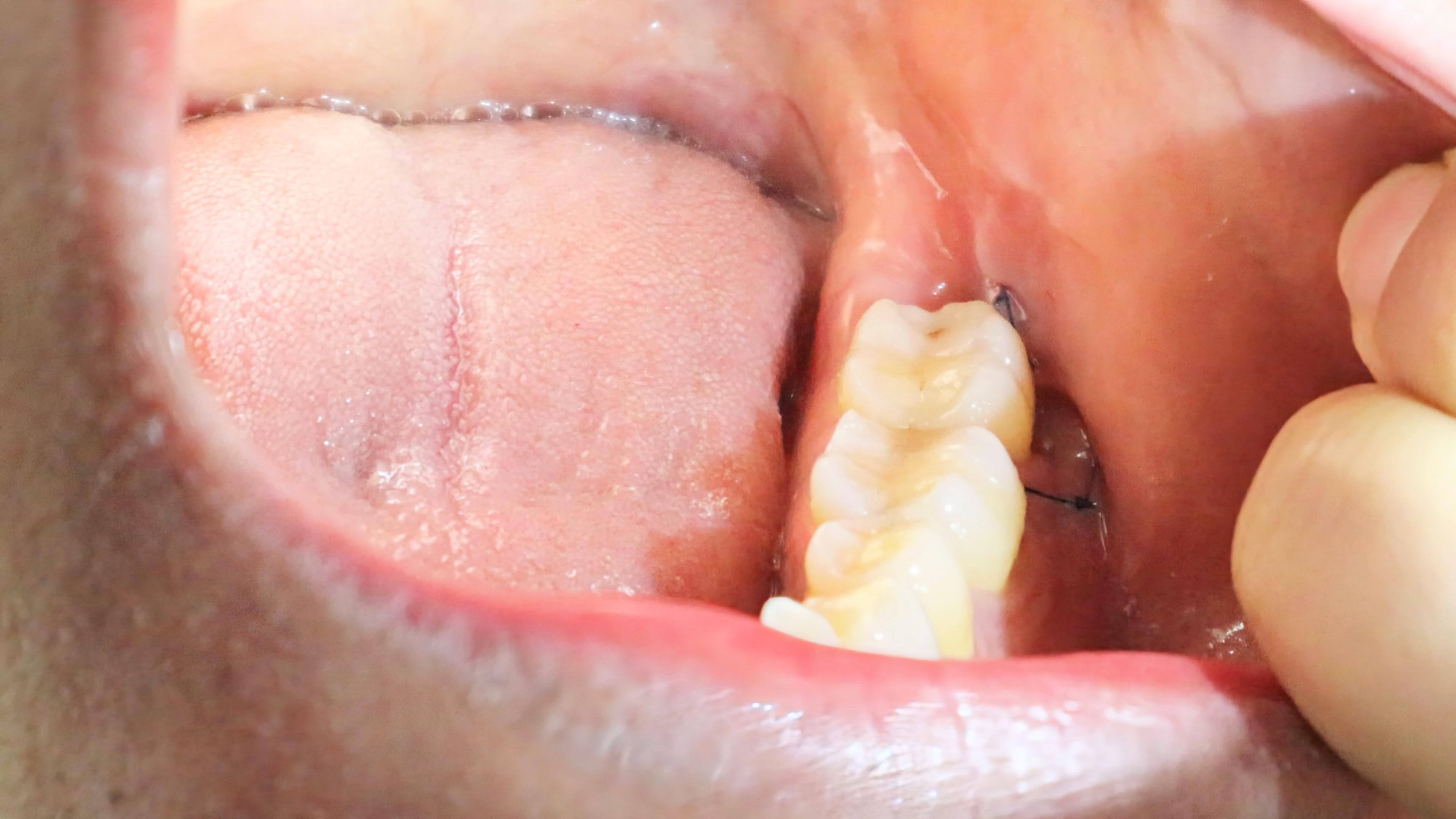 Oral Surgeon NYC