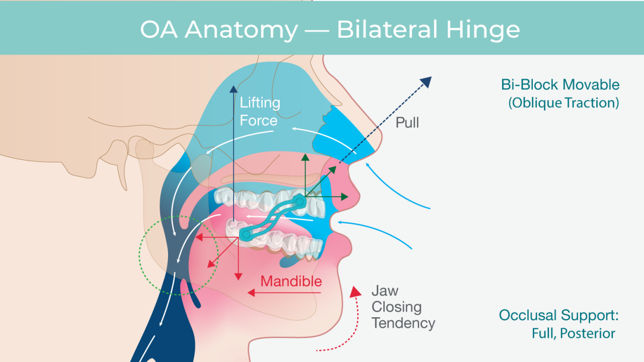 sleep-apnea-treatment-nyc