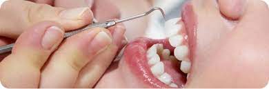 teeth-cleaning-upper-east-side